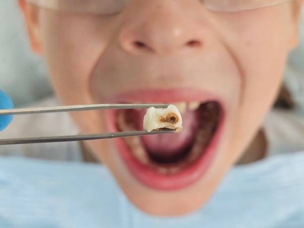 Best Broken or Cracked Tooth Emergency Dentist in Olmsted Falls, OH