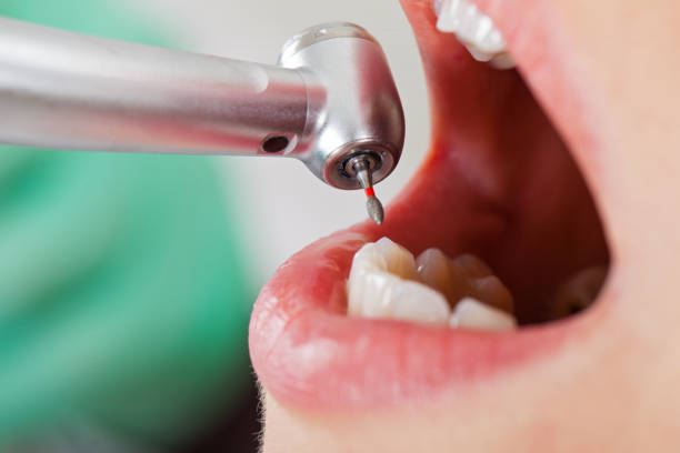 Best Emergency Cosmetic Dentistry in Olmsted Falls, OH
